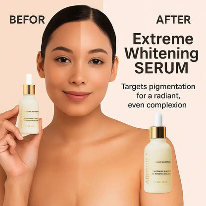 Intense Dark Spot Corrector Serum for Face, Neck & Body (30ml) | Ammuri-3