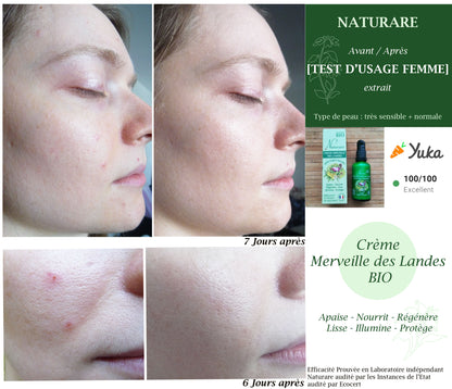 DROP - MERVEILLE DES LANDES ORGANIC - Sensitive Skin Care Complete Regeneration-9