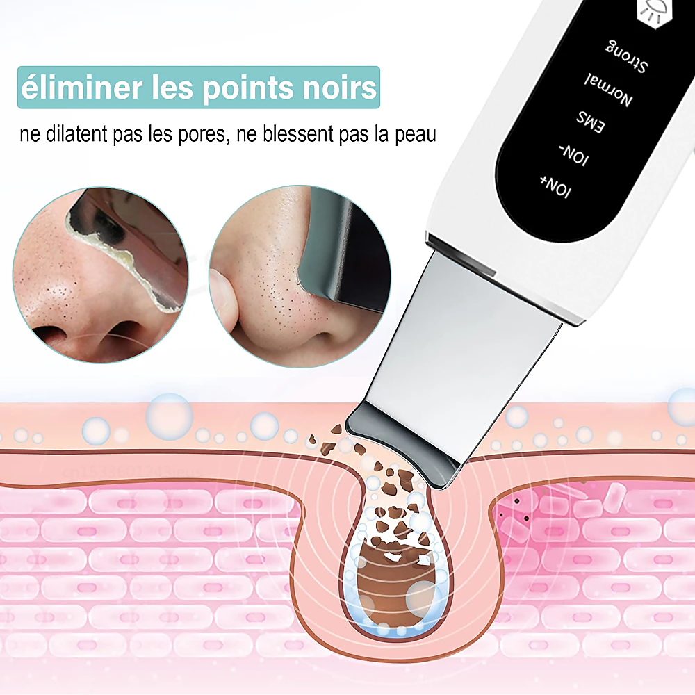 STELLAR - 5-Function EMS Lifting Exfoliator - Ultrasound & Photon Treatment-8