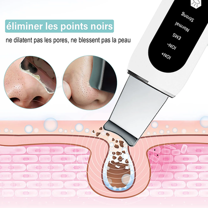 STELLAR - 5-Function EMS Lifting Exfoliator - Ultrasound & Photon Treatment-8
