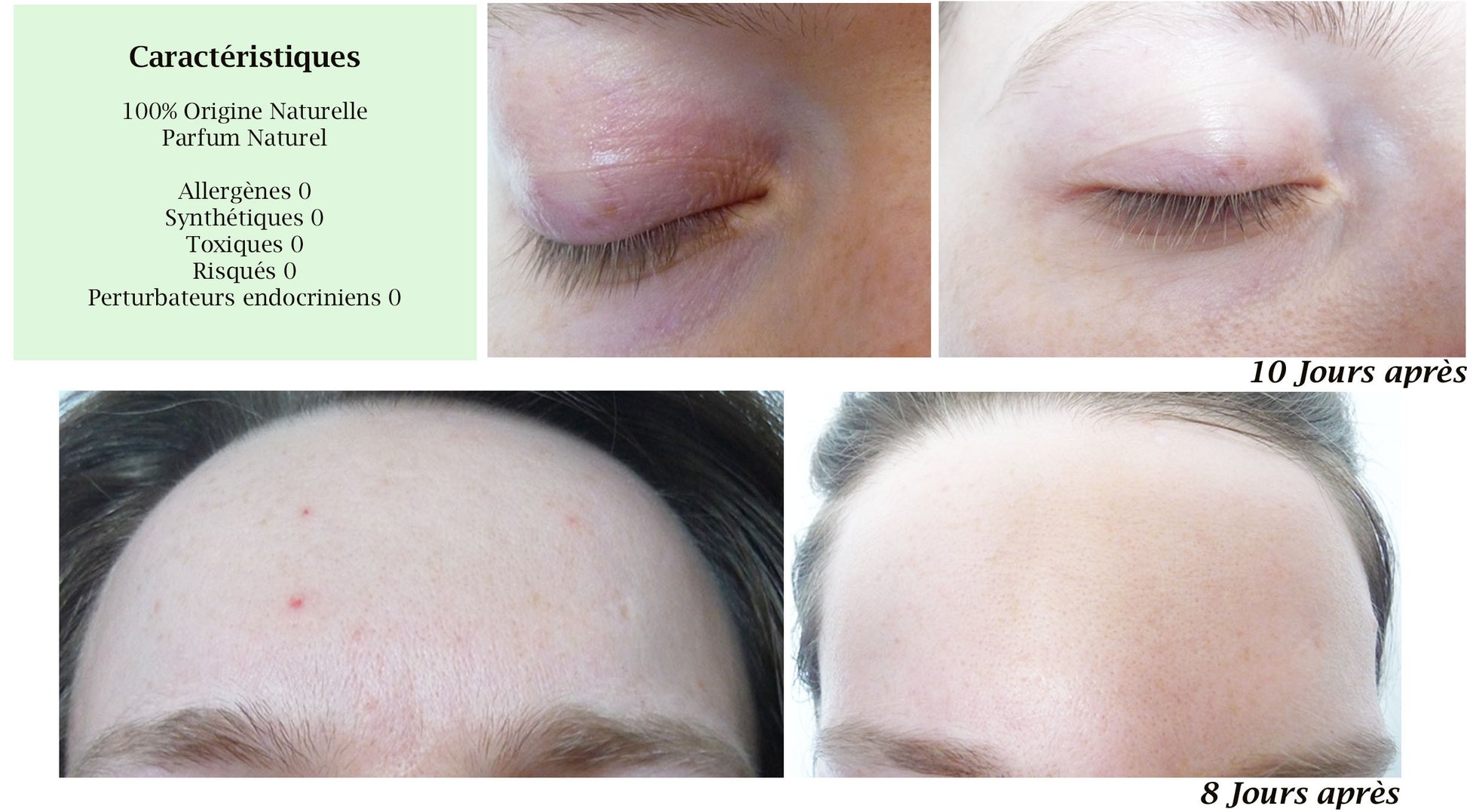 DROP - MERVEILLE DES LANDES ORGANIC - Sensitive Skin Care Complete Regeneration-10