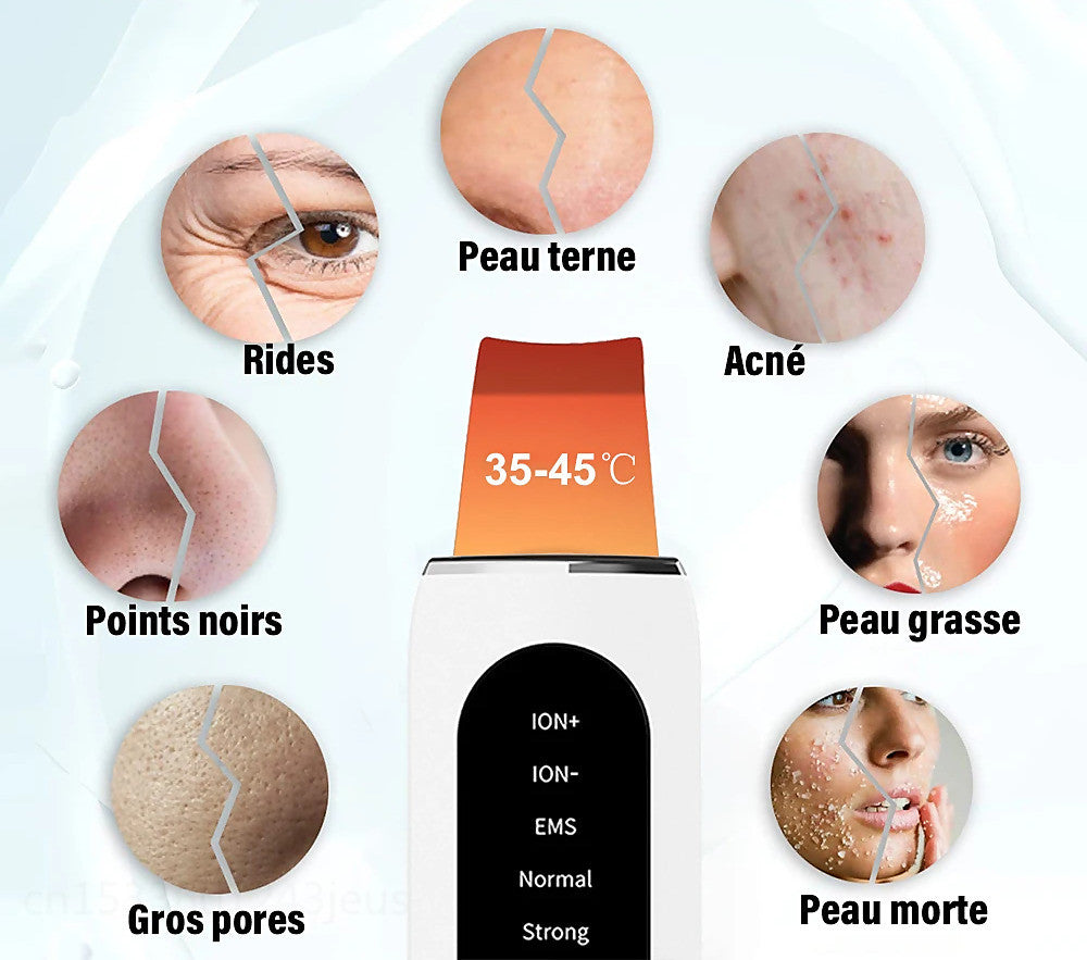 STELLAR - 5-Function EMS Lifting Exfoliator - Ultrasound & Photon Treatment-3